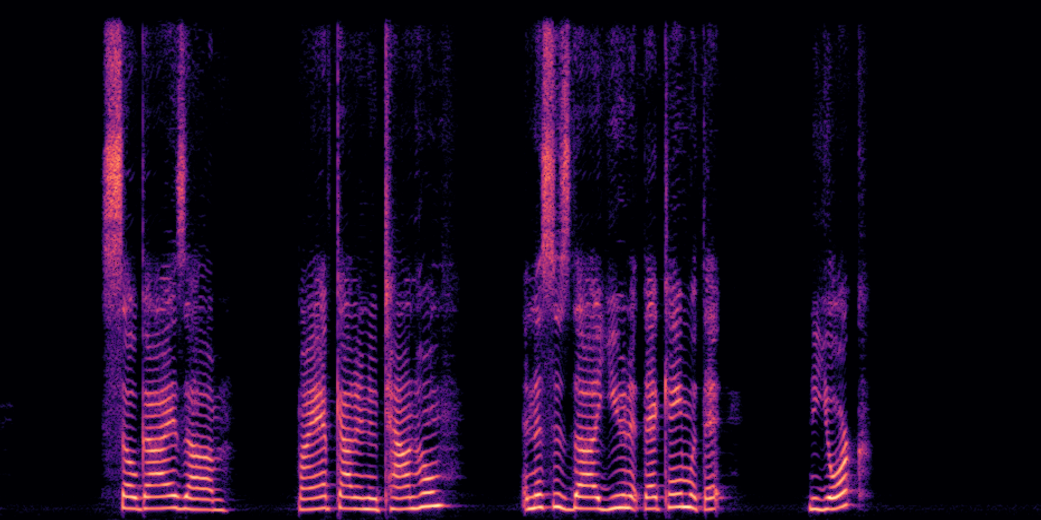 Enhanced Spectrogram